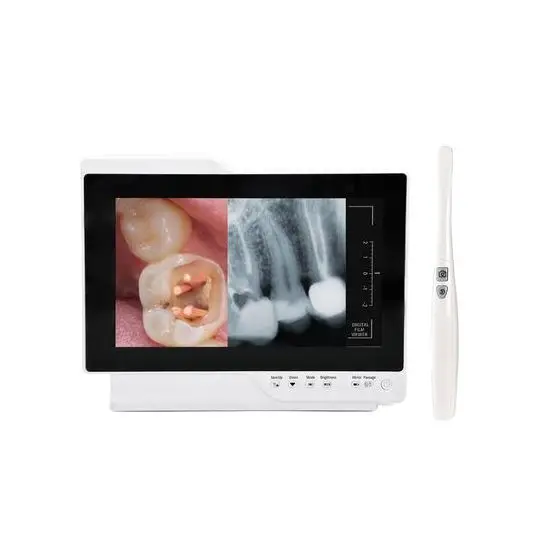 Câmera intraoral com monitor 2 em 1 - imagem 1
